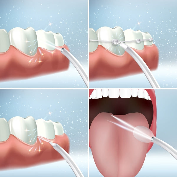 Prijenosni punjivi oralni irigator Denter Innovagoods